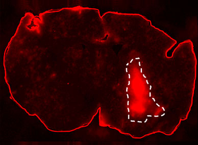 Micrograph with outlined tumor for test of blood-brain barrier integrity in mouse pretreated with placebo plus injection of Texas Red dextran